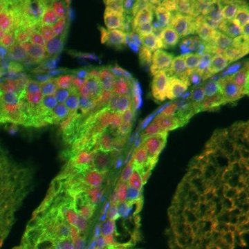Pathogenic variants of histone methyltransferases: structure-function study