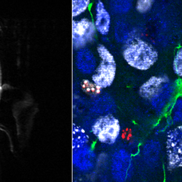 Targeting mitochondrial metabolism in glioblastoma