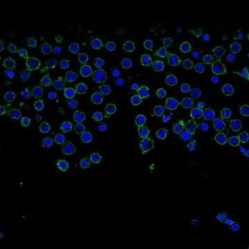 Multi-Combination Vertical Inhibition of the PI3K/AKT Pathway in B-Cell Lymphomas