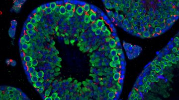 Pozor na cukrovku, ovlivňuje rozmnožování savců. Včetně člověka!