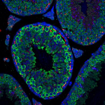 Pozor na cukrovku, ovlivňuje rozmnožování savců. Včetně člověka!