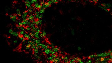Vědci z BIOCEV přinutili rakovinné buňky, aby se samy zničily