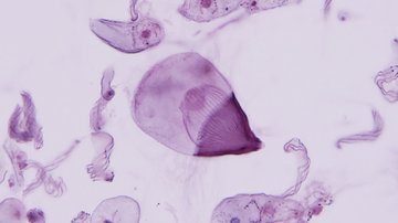 MICOBION - Excelentní projekt centra BIOCEV na posílení spolupráce se zahraničními partnery byl zahájen 1. září