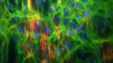 Události ČT: Nové Centrum nádorové ekologie