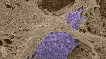 Gratulace Janu Brábkovi za jeho komentář v časopise Cancer World