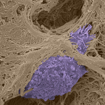 Gratulace Janu Brábkovi za jeho komentář v časopise Cancer World