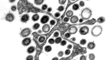 Vědci poodhalili metabolickou kapacitu prvoka z termitů a jeho přidružených bakterií