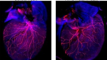 Spolupráce s laureátem Nobelovy ceny - výzkum HIF s  Greggem Semenzou