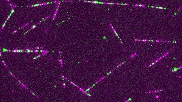 Jako horolezci na laně. Mitochondrie se umí jistit a plynule se pohybovat v davu
