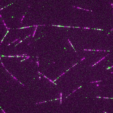 Jako horolezci na laně. Mitochondrie se umí jistit a plynule se pohybovat v davu