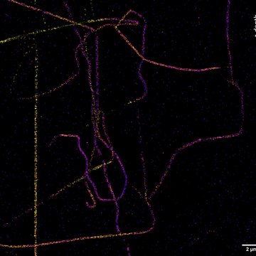 Od organel až k molekulám: super-rezoluční mikroskopie