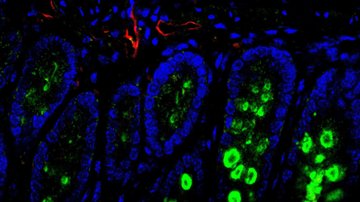 Nová laboratoř v BTU AV ČR se zaměří na metabolismus zdravé tkáně a nádoru