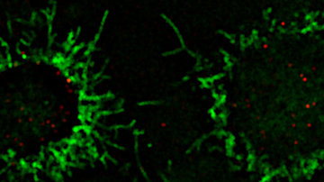 Open Position: Postdoctoral Fellow - Basic tumor biology of lymphomas