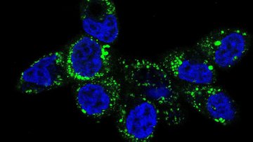 Nový protinádorový cíl: mitochondriální metabolismus železa