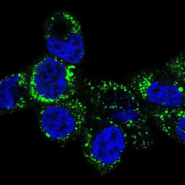 Nový protinádorový cíl: mitochondriální metabolismus železa