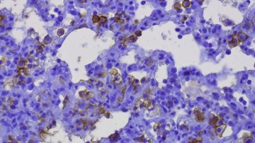 Nově vyvinutá protilátka zabírá na všechny hlavní mutace koronaviru, ověřili čeští vědci