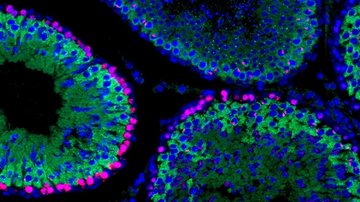 Nový model pomůže zkoumat sníženou plodnost i předčasnou menopauzu
