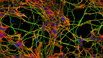 Tau proteinu na stopě