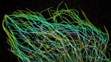 Tajemství transportu látek uvnitř buněk objasní mezinárodní tým s českým vědcem. Na výzkum dostane  270 milionů korun