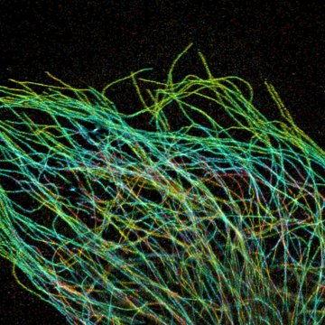 Tajemství transportu látek uvnitř buněk objasní mezinárodní tým s českým vědcem. Na výzkum dostane  270 milionů korun