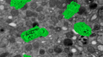 Vědci z centra BIOCEV pomohli objevit mechanismus regulující pohyblivost buněk imunitního systému