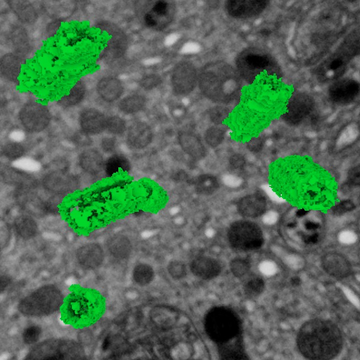 Vědci z centra BIOCEV pomohli objevit mechanismus regulující pohyblivost buněk imunitního systému