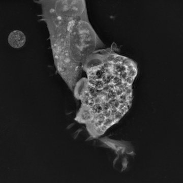 Nové zbraně proti „mozkožroutovi“ a tropickým chorobám díky vědcům z BIOCEV