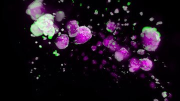 Vědcům se podařilo zjistit funkci proteinu NEUROD1 v rozvoji diabetu