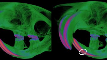 Průlomová studie odhaluje souvislost mezi autoimunitními poruchami a defekty zubní skloviny