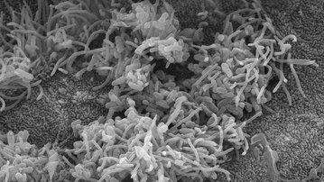 Vědci a lékaři zahájili unikátní studii černého kašle a hledají pacienty