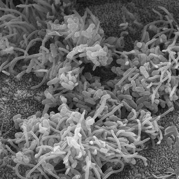 Vědci a lékaři zahájili unikátní studii černého kašle a hledají pacienty