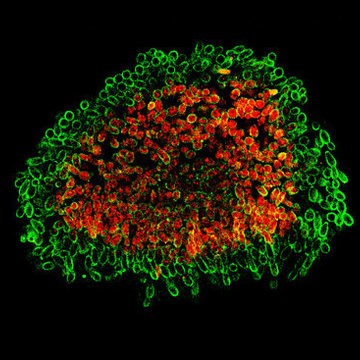Vysoká účinnost i kvalita. Projekt LasApp podpoří nejmodernější vláknové a tenkodiskové lasery a jejich využití