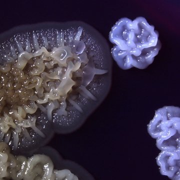 Nové poznatky o regulaci aktivity transkripčního faktoru Gcn4 v prostorově strukturovaných populacích kvasinek