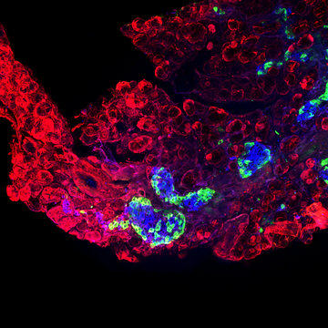 Molekulární patogenetika