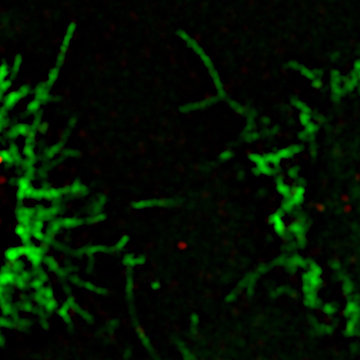 Výzkum nádorové biologie lymfomů
