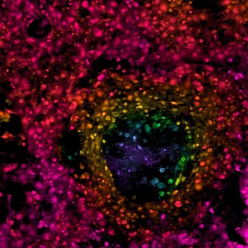 Bioarteficiální struktury pro náhradu a regeneraci poškozených tkání