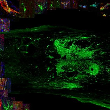 Využití kmenových buněk a biomateriálů v buněčné terapii