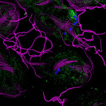 Mechanismy transportu proteinů přes mitochondriální a bakteriální membrány
