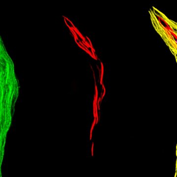 Genomika eukaryot a laterální genový přenos