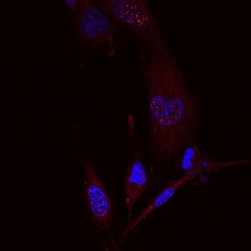 Buněčné funkce proteinů účastnících se drah proteasom-ubikvitinového systému ve vztahu k nádorovému bujení