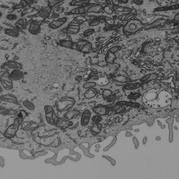 Interakce virových a buněčných struktur v průběhu virové infekce a vývoj nanostruktur pro medicínské a veterinární účely