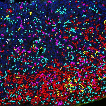 Imunizace proti nádorům vyvolaným lidskými viry