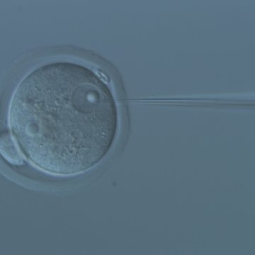 Laboratoř hematoonkologie a kmenových buněk