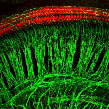 Buněčná komunikace v zánětlivých odpovědích