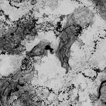 Leukocytární motilita